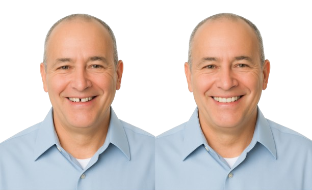 Partial dentures teledentistry Partial dentures teledentistry