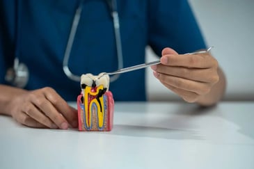 Root Canal Therapy
