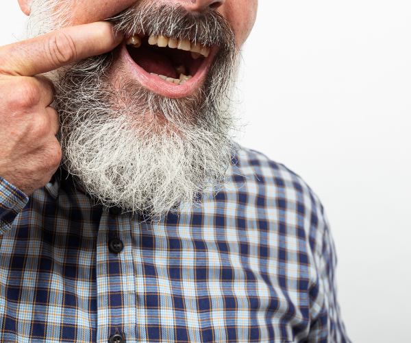 partial denture missing tooth