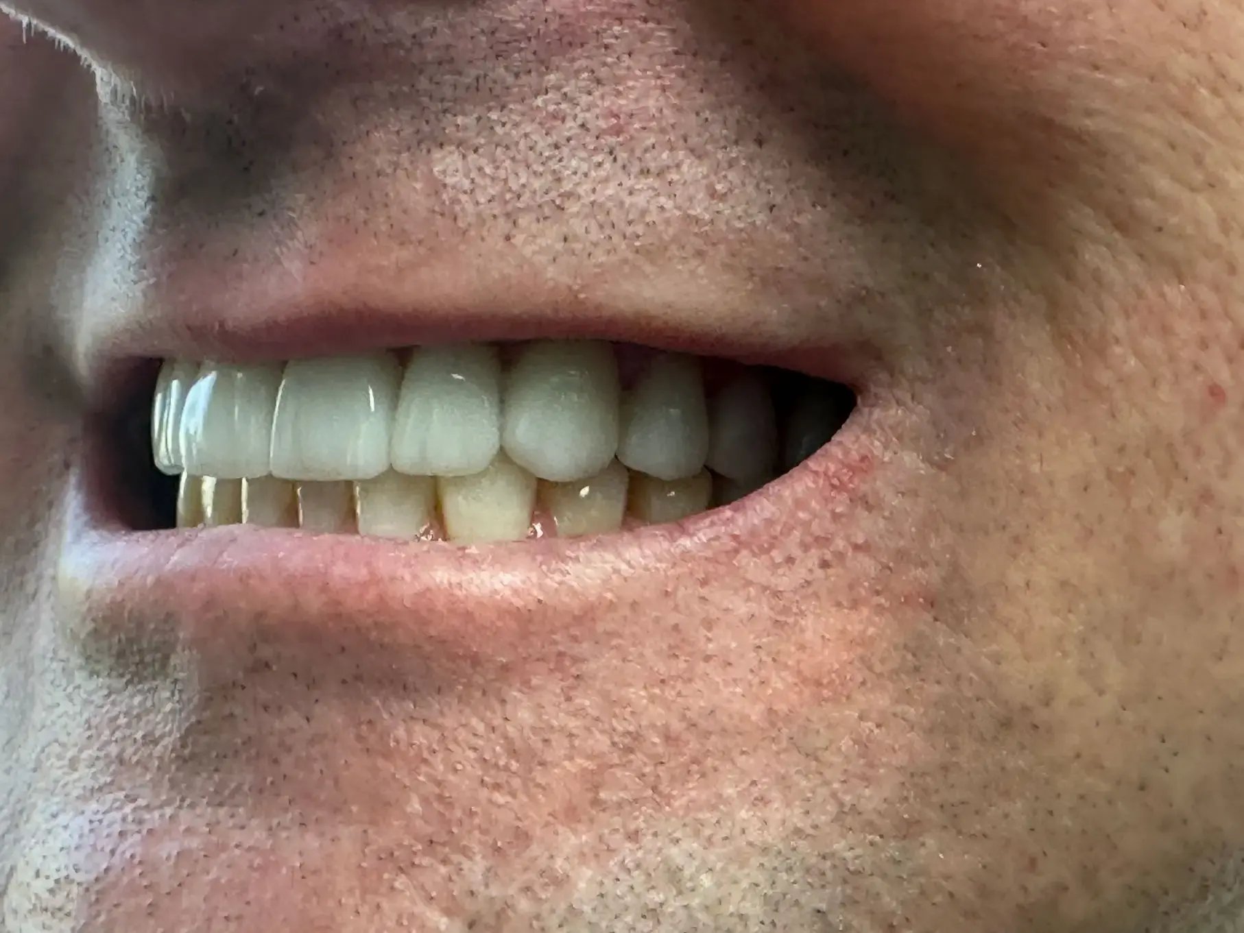 bite photo analysis teledentistry