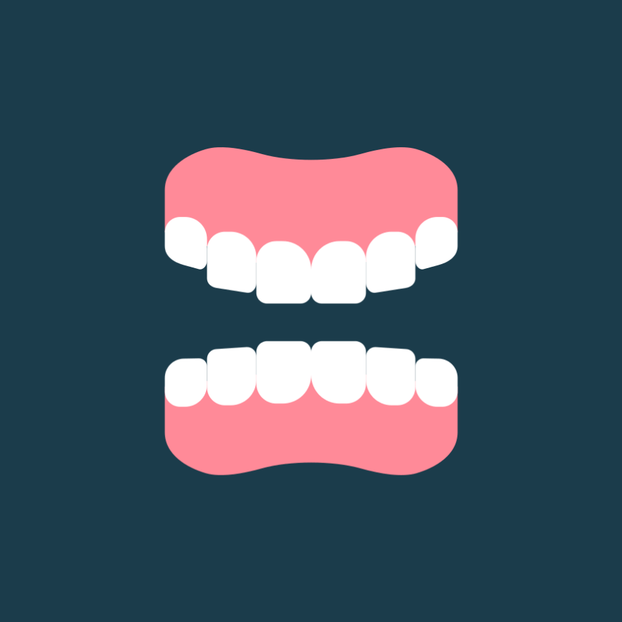 both arches partial dentures