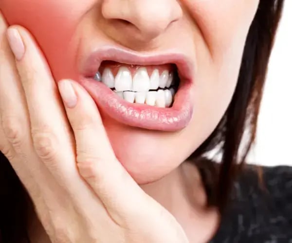 chipped tooth