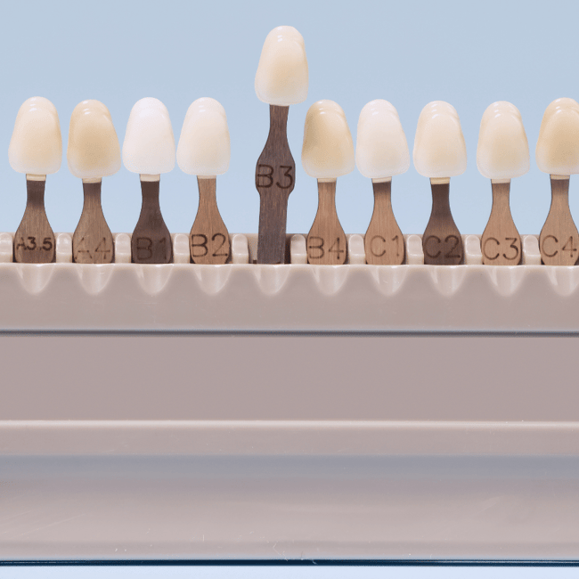 partial denture shade matching