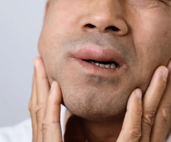 facial swelling