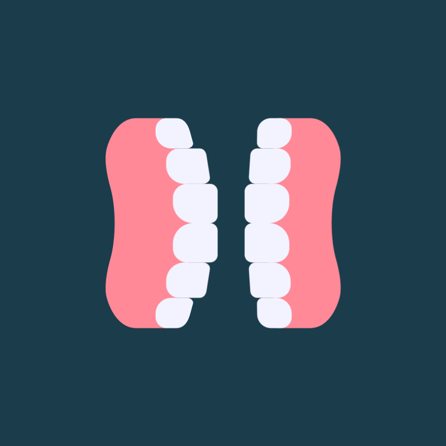 upper or lower arch partial denture