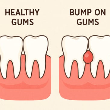 bump on gums