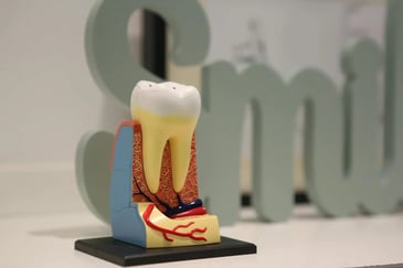 exposed tooth root