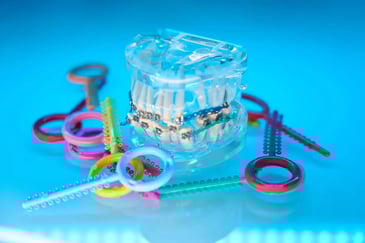 Orthodontic treatment